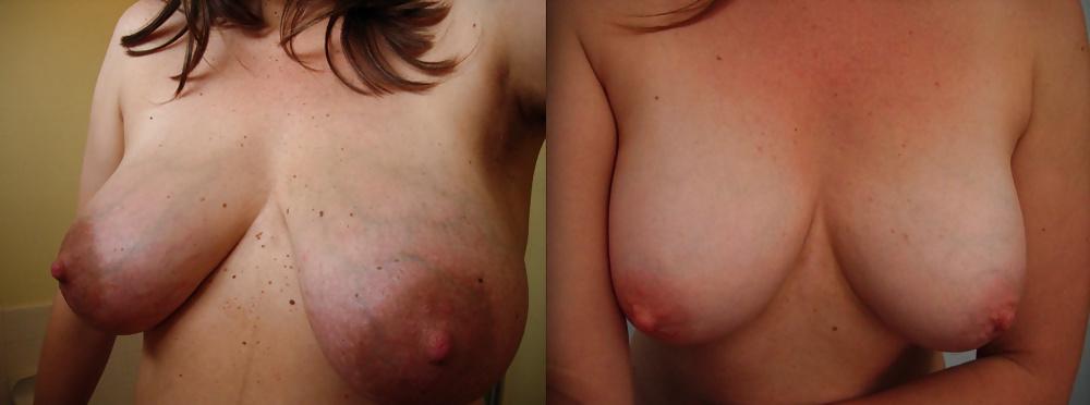 7P Mom shares her tits through the years...
