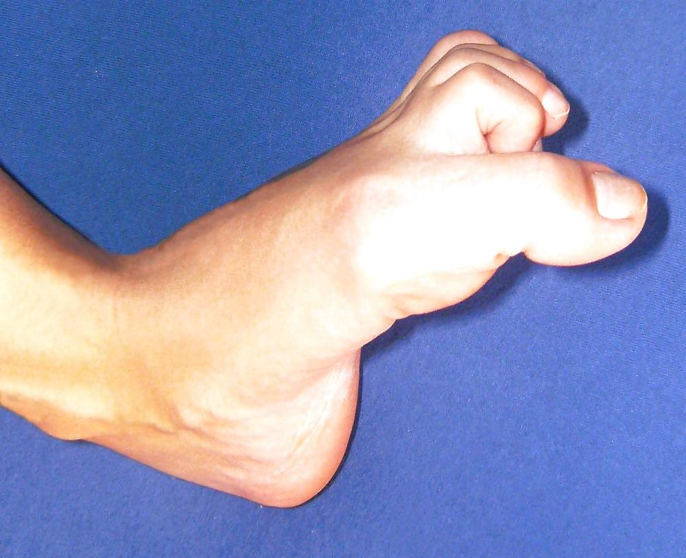 16P Kiki 's Feet - Foot model curls her flexible toes