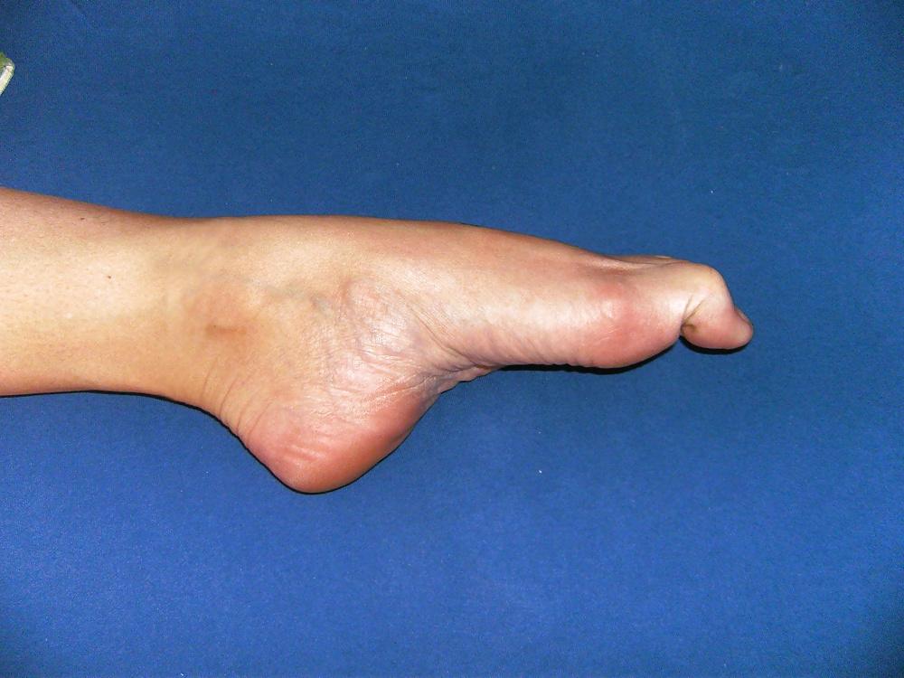 16P Kiki 's Feet - Foot model curls her flexible toes