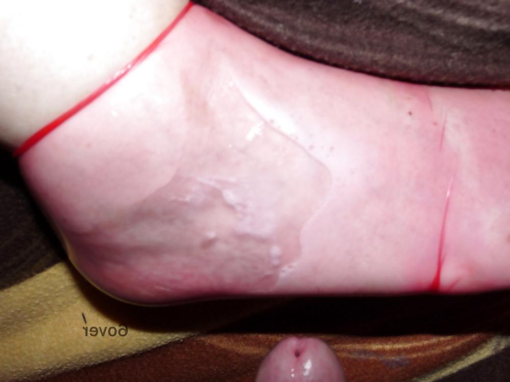 13P Mit Sperma gefuelltes Condom am Fuss von 6over