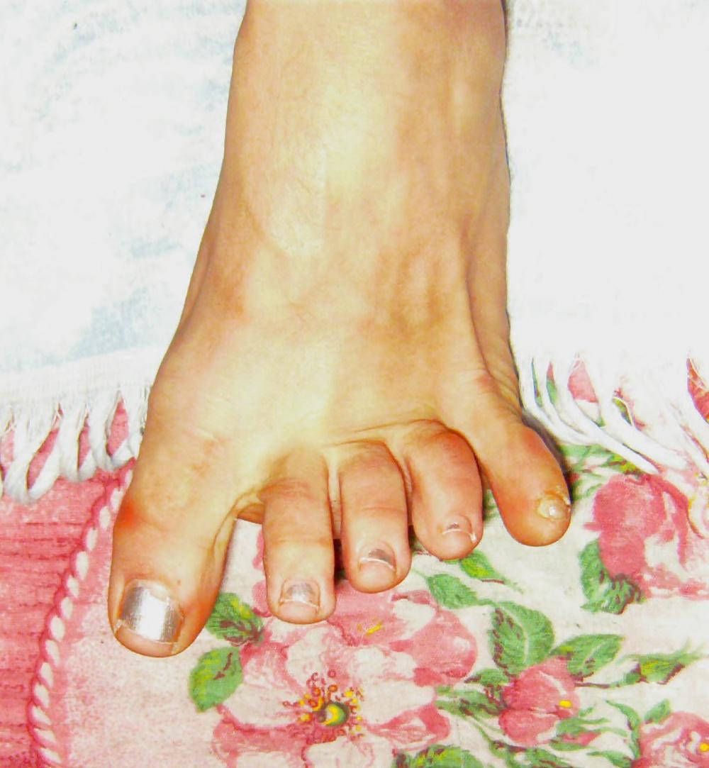 11P Marta 's Feet - Foot model spreads curls her flexible toes