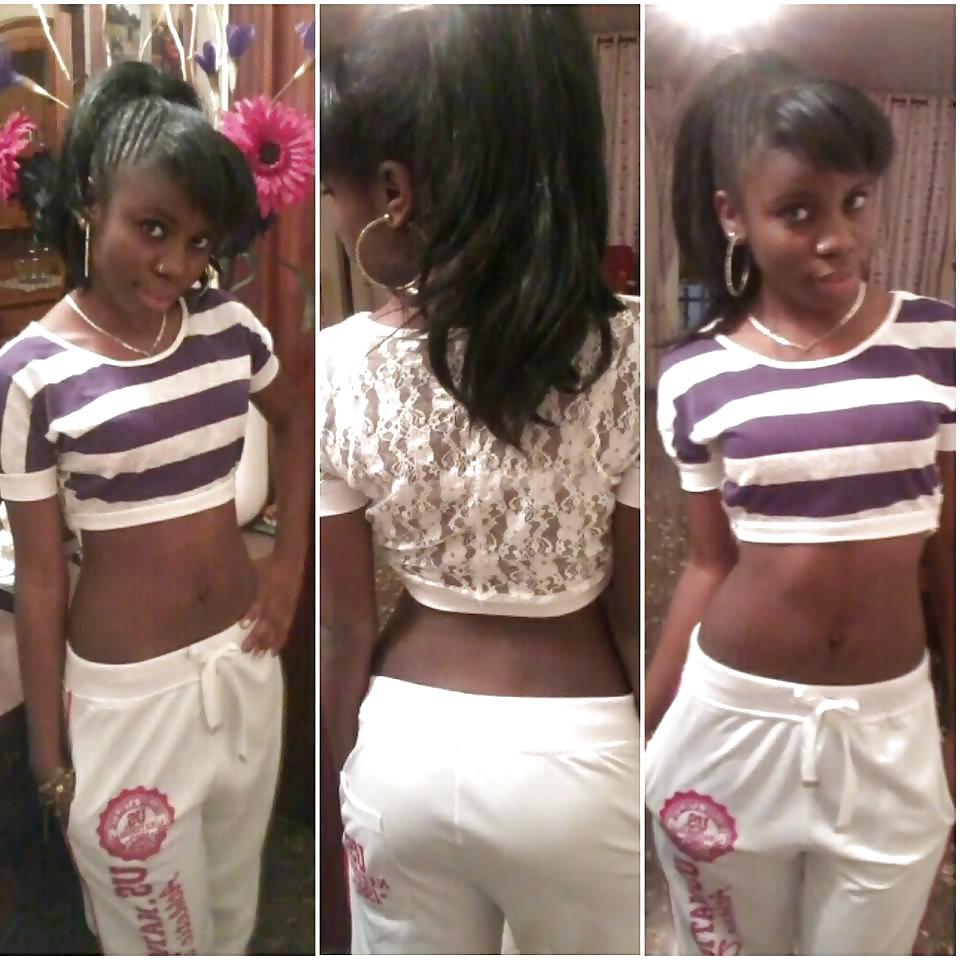 20P Black Beauty Teen