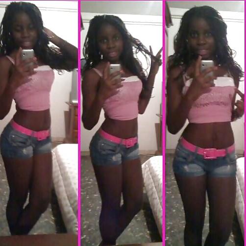 20P Black Beauty Teen