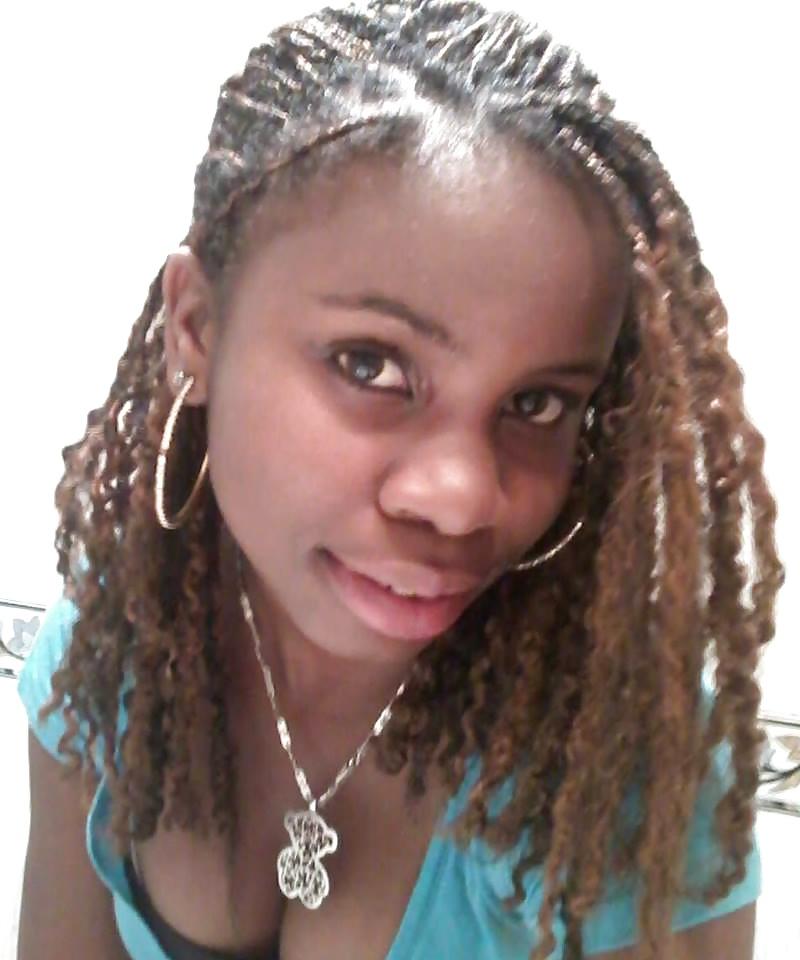20P Black Beauty Teen