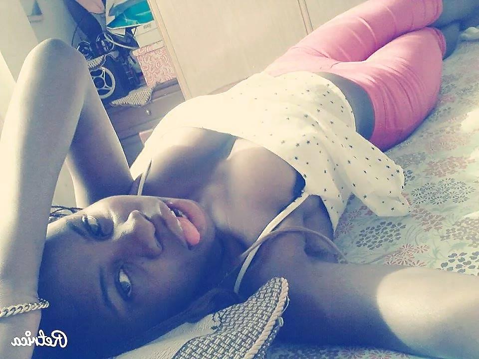 20P Black Beauty Teen