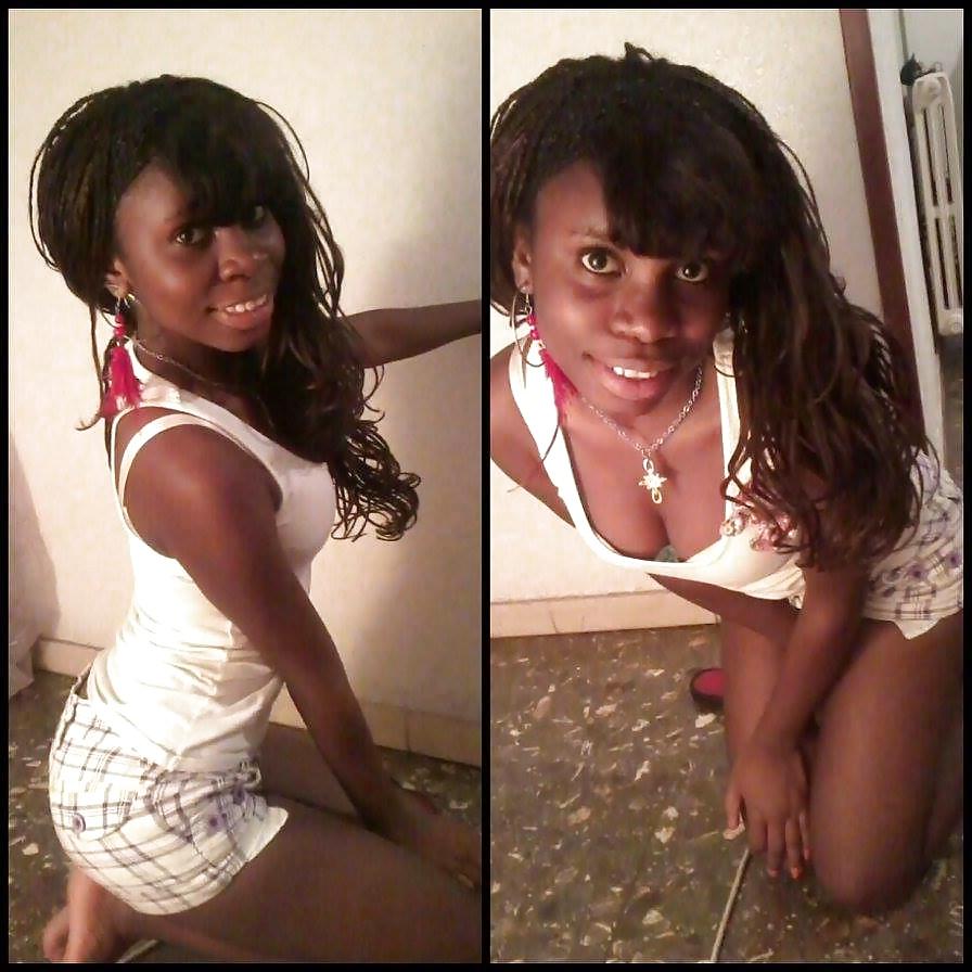 20P Black Beauty Teen