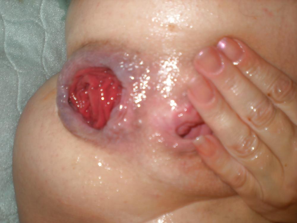 15P Ass fisting
