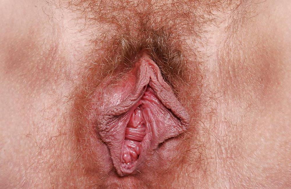 13P Beauty hairy