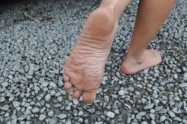25P Foot