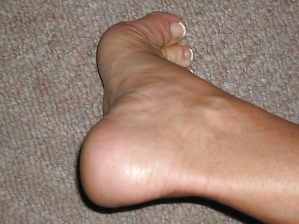 25P Foot