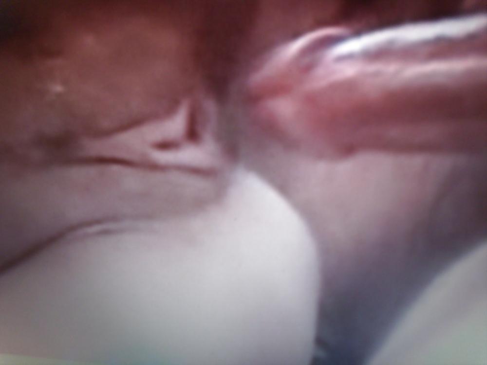 25P Blasen und lecken