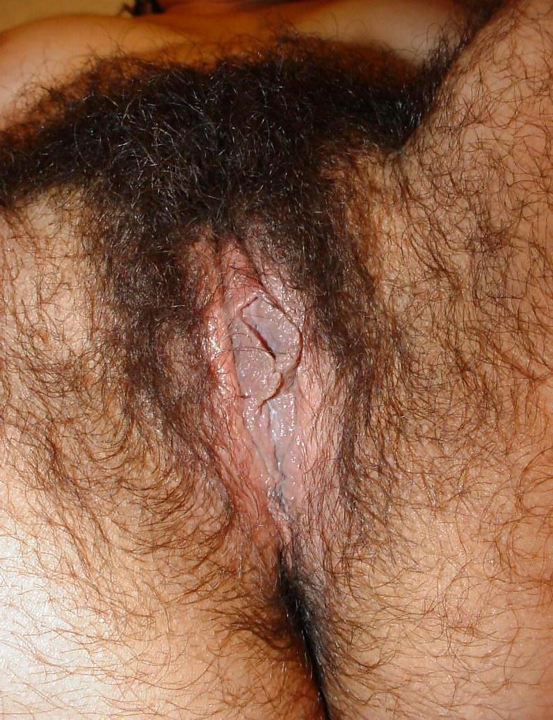 25P Mexican Hirsute Queen - 7- 7of9