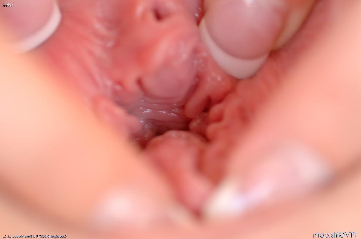 20P Pictures of a blonde teen spreading her pussy wide open