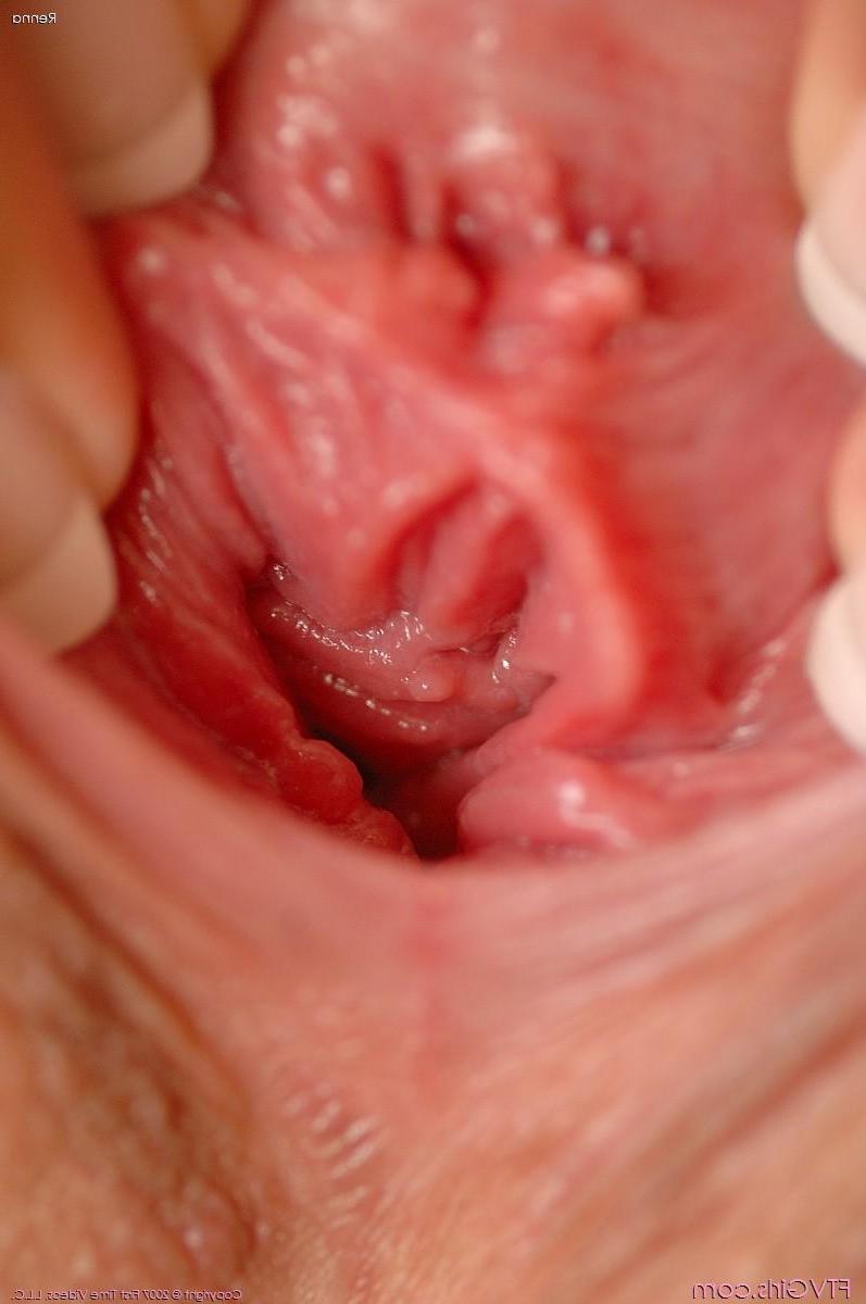 20P Pictures of Renna spreading her pussy lips wide open