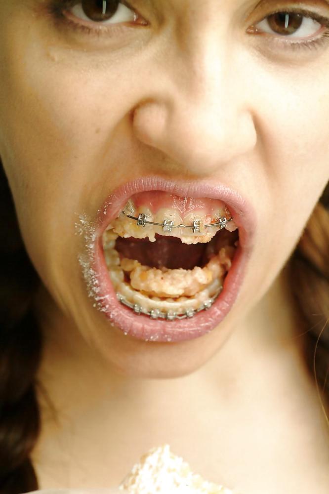 25P Beauty&Braces