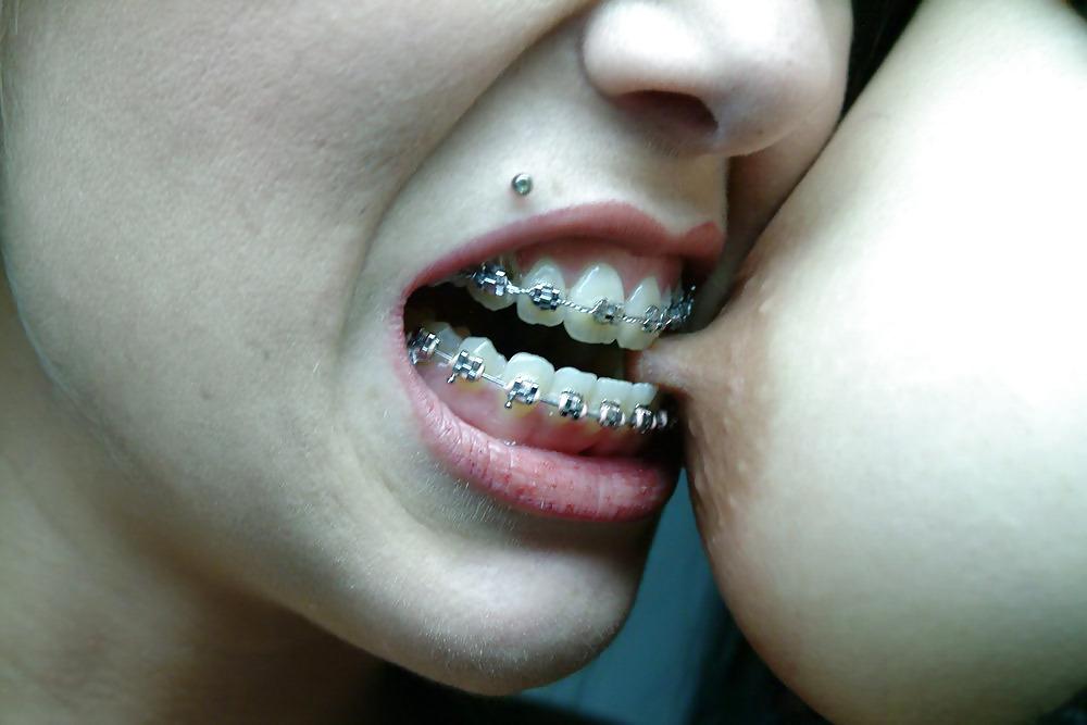 25P Beauty&Braces
