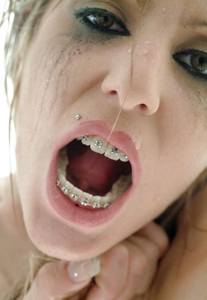 25P Beauty&Braces