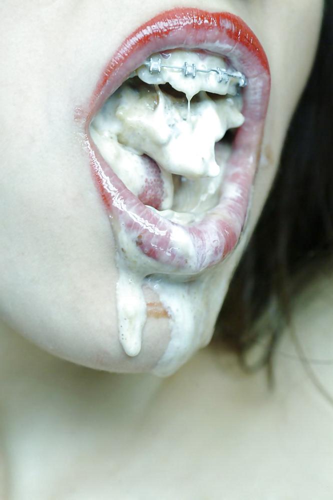 25P Beauty&Braces