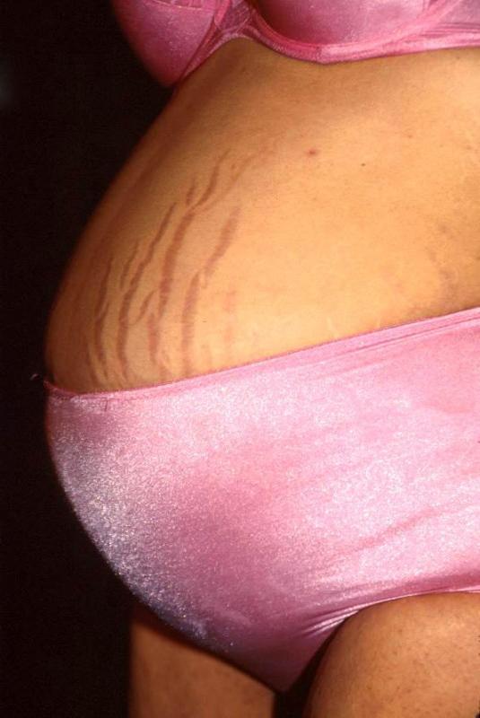 15P Happy preggo bitch in lite bondages