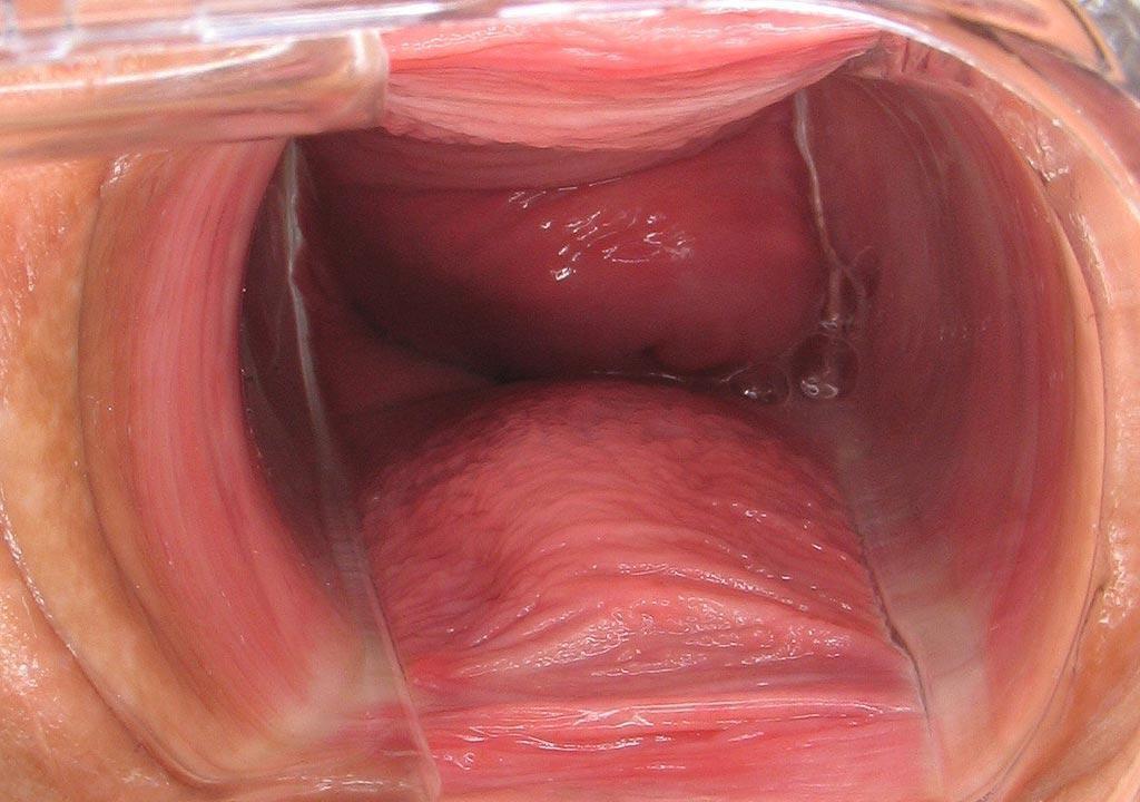 16P pussy and anal speculum insertions close ups