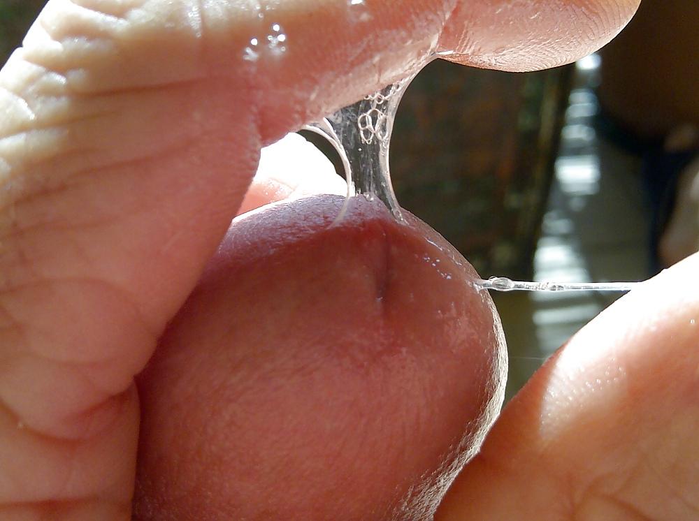 22P Post vasectomy masturbation