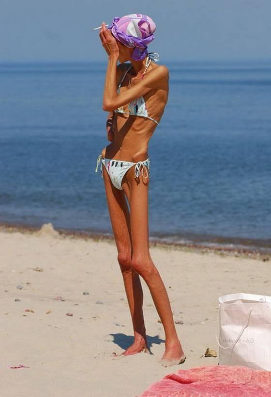 15P skinny anorexic girls posing nude for food