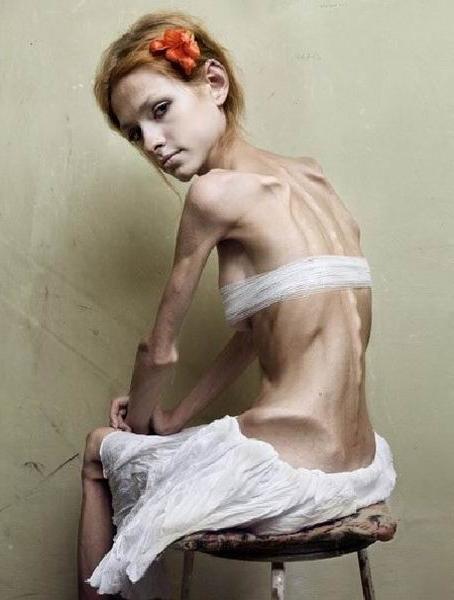 15P skinny anorexic girls posing nude for food