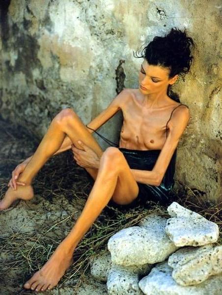 15P skinny anorexic girls posing nude for food
