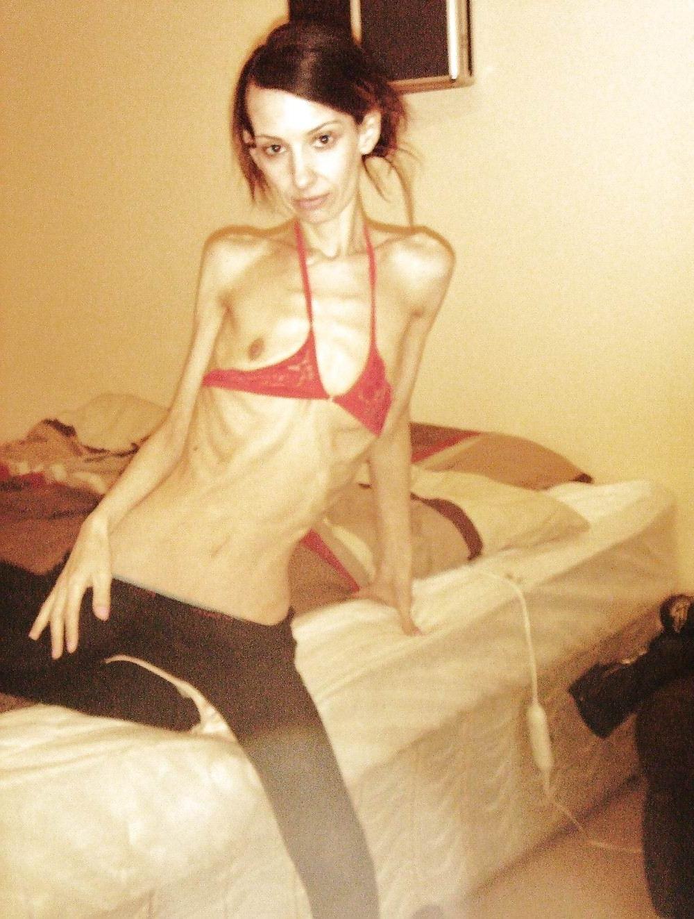 15P skinny anorexic girls posiing for food