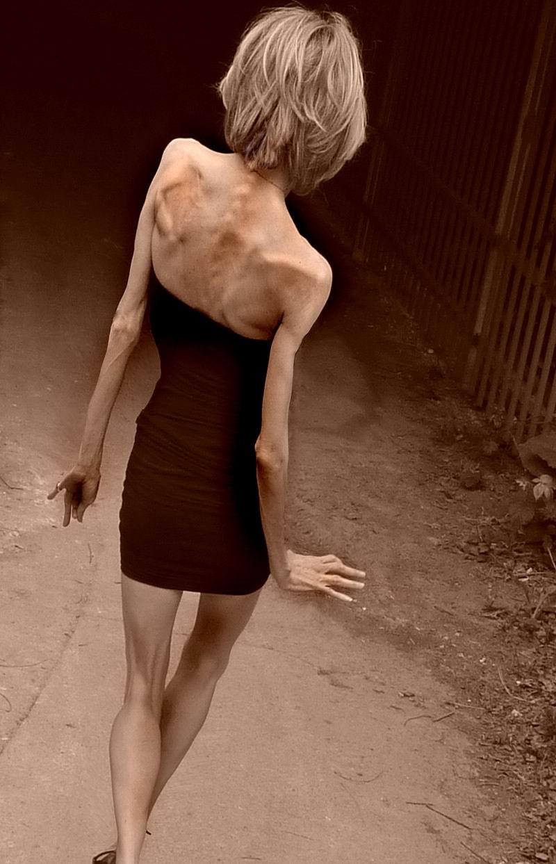 15P skinny anorexic girls posiing for food