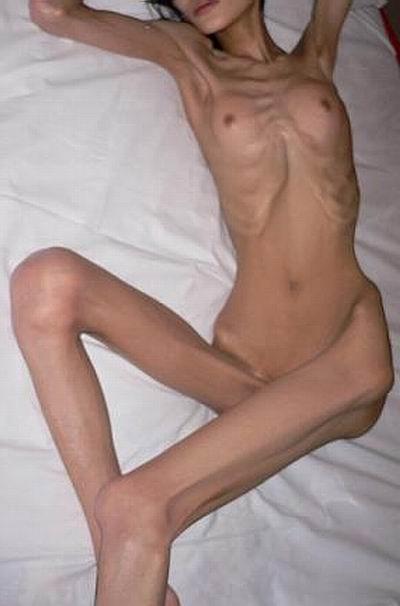 15P skinny anorexic girls posing nude for food