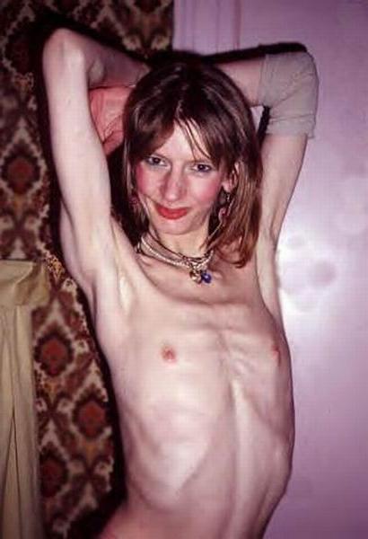 15P skinny anorexic girls posing nude for food