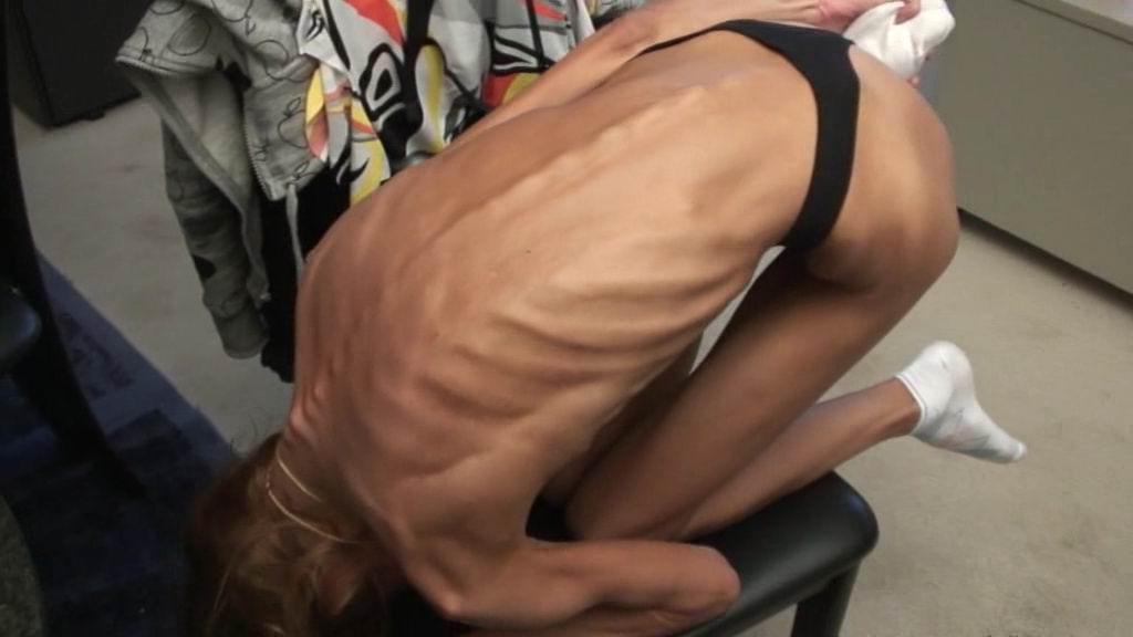 16P anorexic girl posing for food