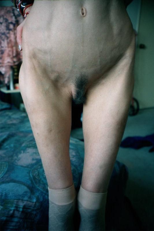 15P anorexic girls posing and fucking for food