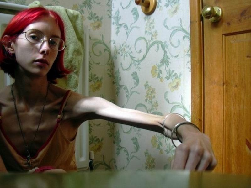 12P extremely skinny girls posing nude for food