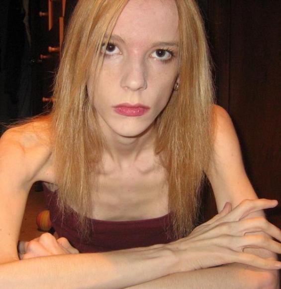 12P extremely skinny girls posing nude for food