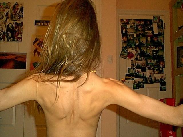12P extremely skinny girls posing nude for food