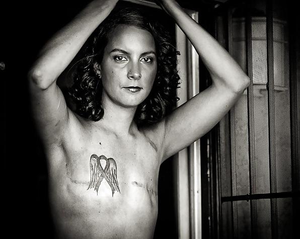 24P Beauty beyond the scar