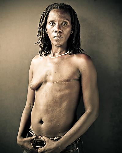 24P Beauty beyond the scar