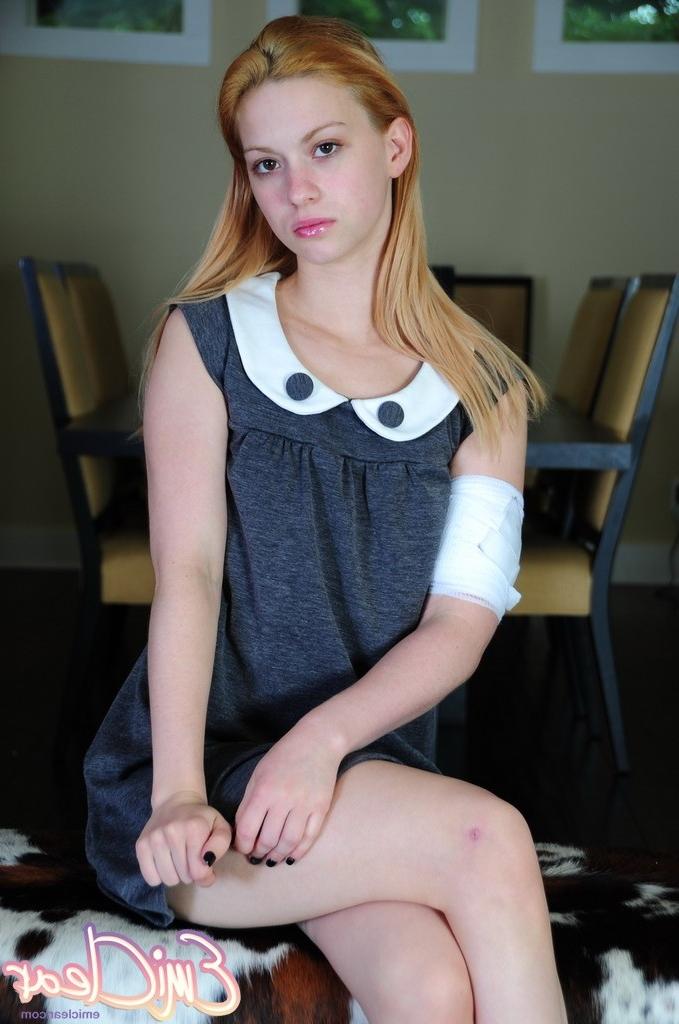 16P Teen with bandaged arm