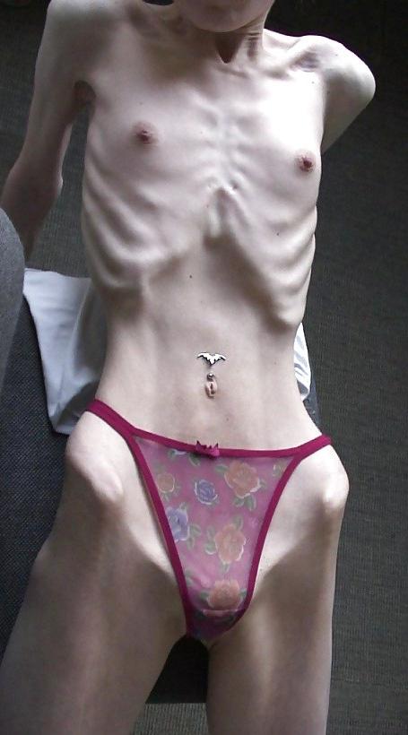 15P Young sexy skinny and anorexic girls