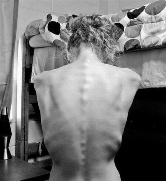 12P extremely skinny girls posing nude for food