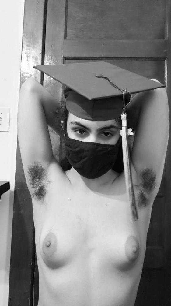 10P hairy teen