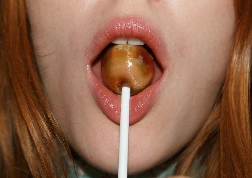 25P Oral Fixation