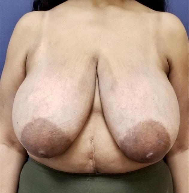 25P Erotic beauty 62