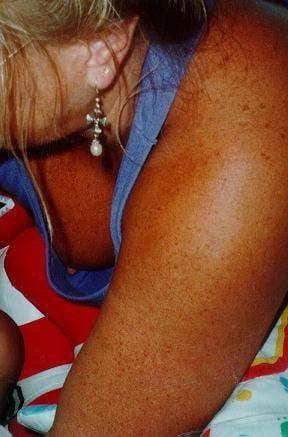 25P Downblouse 2