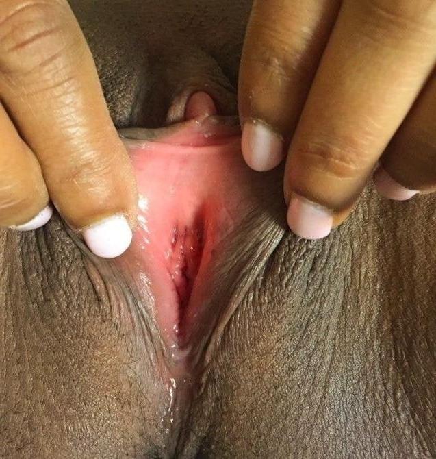 25P WNE 918 - Good Genetics - Indian Desi Version