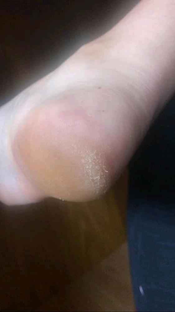 25P foot mix 1
