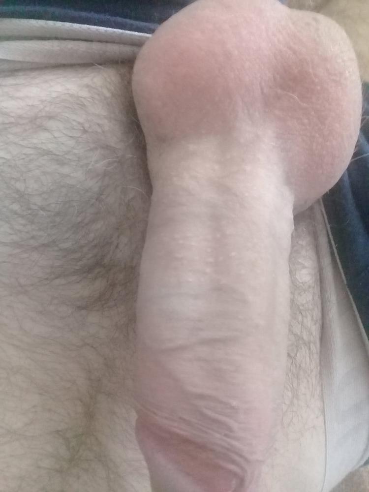 10P My Dick