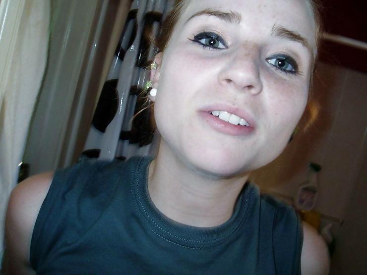 25P Freckled Redhead Teen